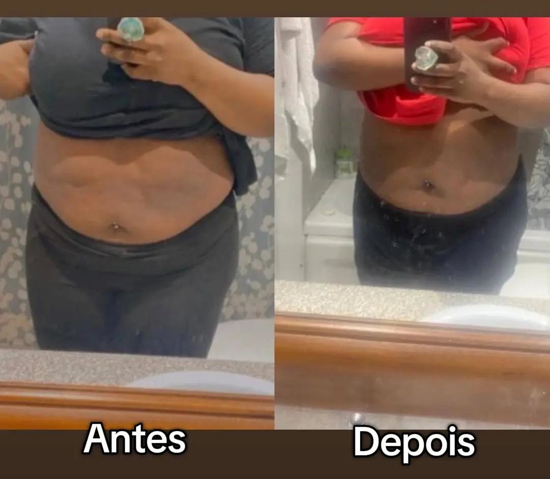 Antes e depois — resultado real